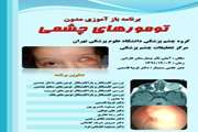 اطلاعیه برگزاری برنامه بازآموزی مدون با موضوع تومورهای چشمی  در بیمارستان فارابی